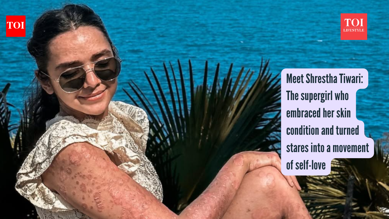 Meet Shrestha Tiwari: The supergirl who embraced her skin condition and turned stares into a movement of self-love |