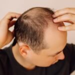 Scientists develop plant-based serum that regrows hair within weeks |