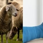 Scientists turn sheep wool into a bone-healing material in a major medical breakthrough |