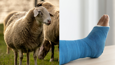Scientists turn sheep wool into a bone-healing material in a major medical breakthrough |