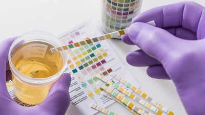 Your urine colour could be warning you about hidden health problems, what every shade really means