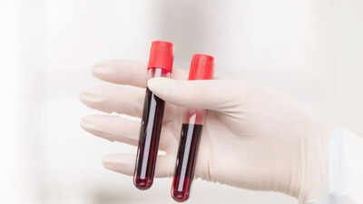 World’s rarest hybrid blood type discovered in Thailand: Study found in just 3 people out of a massive research of 544,000 samples | World News