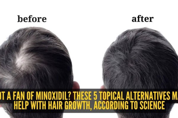 5 topical minoxidil alternatives to increase hair growth