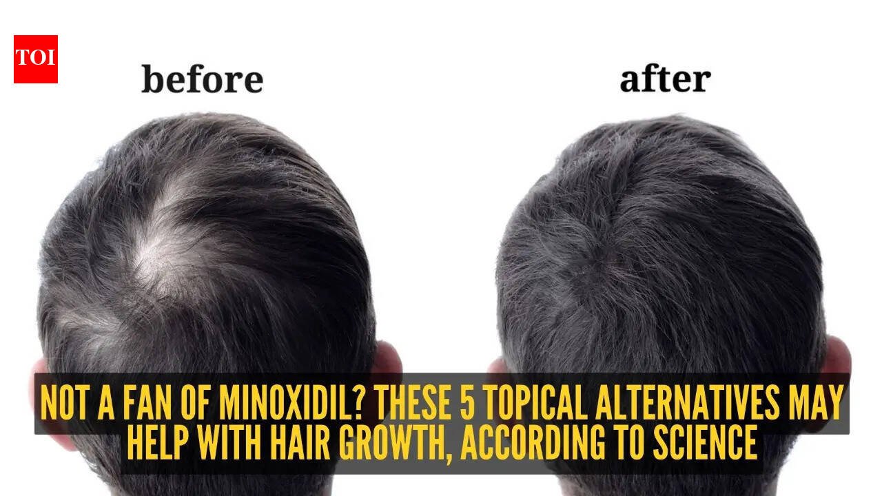 5 topical minoxidil alternatives to increase hair growth