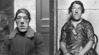 World'S Ugliest Woman: The reason this mother accepted the title of ‘World’s Ugliest Woman’ will break your heart