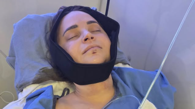 Rosanna Pansino Surgery: YouTuber Rosanna Pansino undergoes surgery after breaking jaw in boat accident