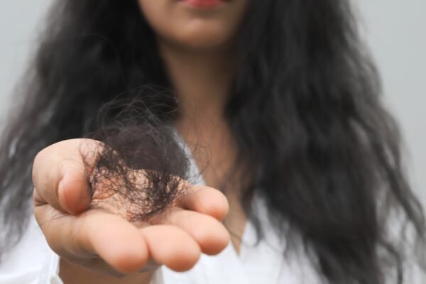 ​Eating these 8 foods excessively may contribute to hair fall