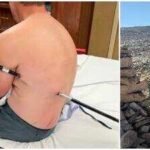A man impales himself on trekking pole while climbing Montana's highest peak, hikes 10 miles to safety instead of calling a helicopter