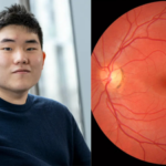 Award-winning innovation: 17-year-old New Jersey student built an AI that detects autism and ADHD with a retinal scan |