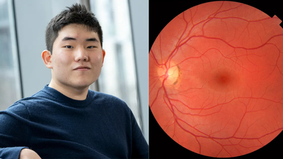 Award-winning innovation: 17-year-old New Jersey student built an AI that detects autism and ADHD with a retinal scan |