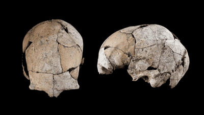 Buried for 5,300 years beneath a Stone Age tomb, a skull discovered in Spain has revealed the world's earliest known ear surgery |