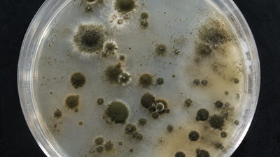 How Chornobyl's mysterious fungus could change medicine and future space missions |
