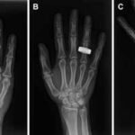 For the first time in history, astronauts use portable X-ray technology in space that could pave the way for future Moon and Mars missions