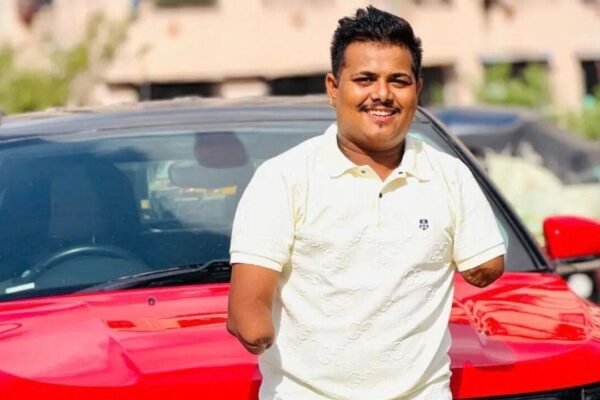 “I lost my hands that day, but I never lost...”: A driver's heartbreaking journey from a life-changing accident to rebuilding his life for his family