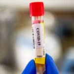 Indian-origin lab owner charged in US over $66.2 million bogus Covid test claims: DOJ | World News