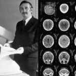 In 1971, engineer Godfrey Hounsfield’s new scanner revealed a brain cyst in the first clinical CT scan; 8 years later, he shared the Nobel Prize for developing computer-assisted tomography