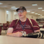 'I'm not broken...': At 21, he survived burns on 85% of his body after a gas explosion, years later he prepares school lunches for hundreds of students while building his dream life