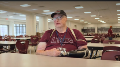 'I'm not broken...': At 21, he survived burns on 85% of his body after a gas explosion, years later he prepares school lunches for hundreds of students while building his dream life