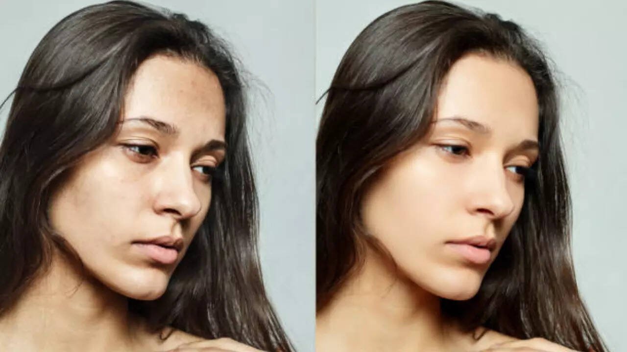 Tanning or dark spots? How to tell what your skin is actually dealing with