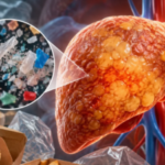 Researchers found that polyethylene microplastics worsened signs of fatty liver, especially when combined with an unhealthy diet, raising questions about a plastic used in everyday packaging